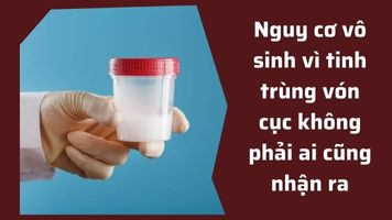 Vô sinh vì tinh trùng vón cục