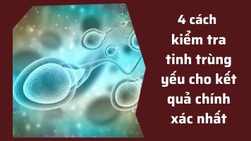Cách kiểm tra tinh trùng yếu