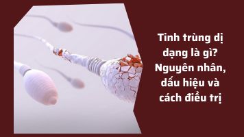 Tinh trùng dị dạng